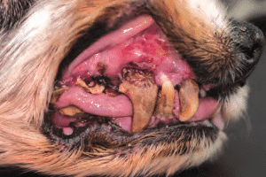 Stade 4 Maladie parodontale avancée